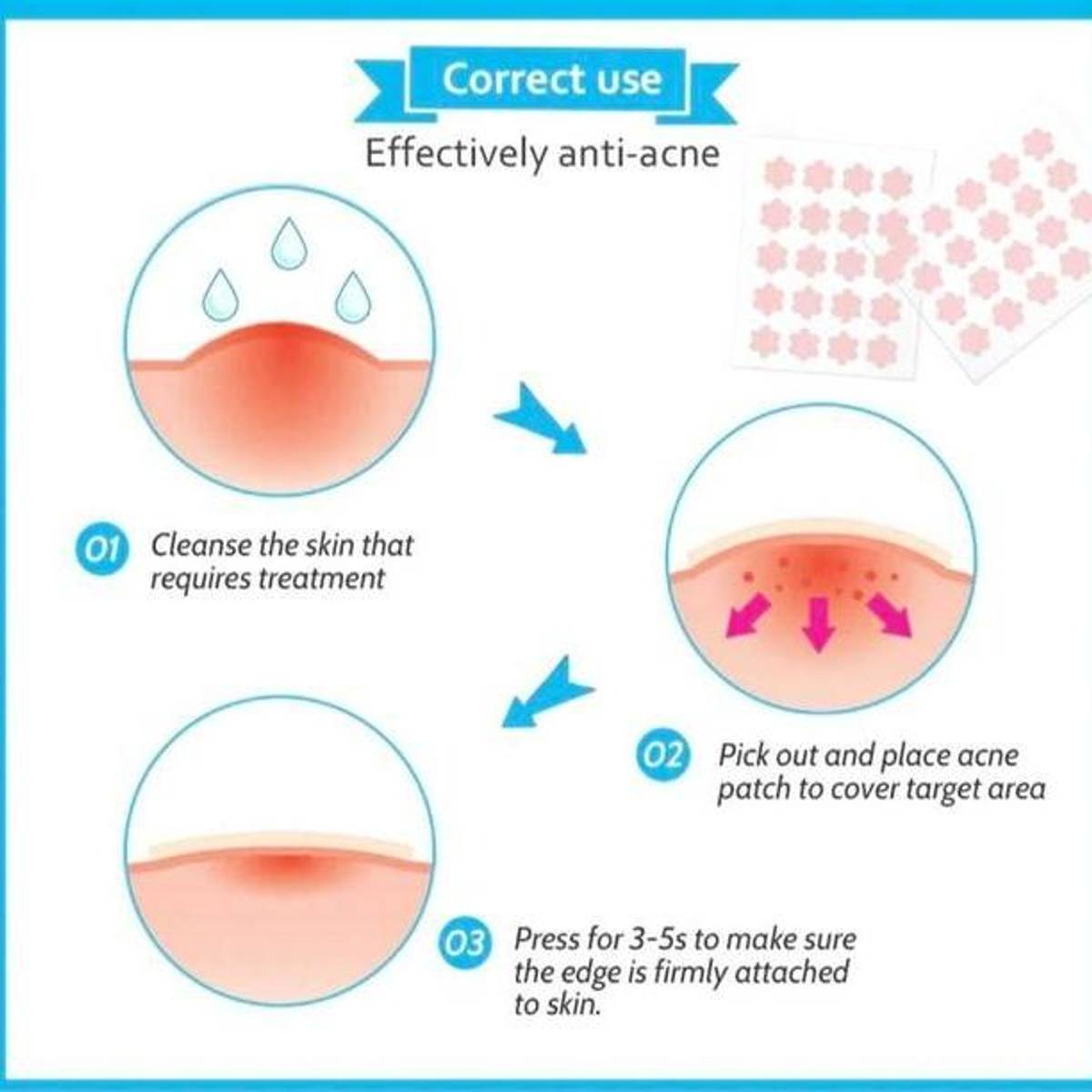 Liyalan Acne Patch (20 stk)