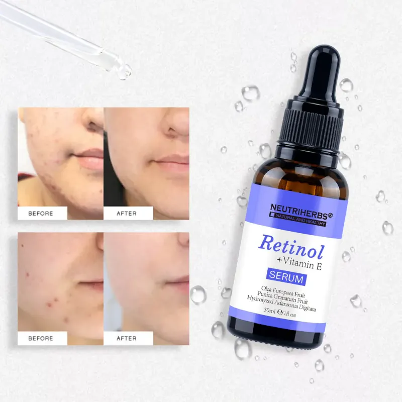 Neutriherbs Retinol + Vitamin E Serum 0,5%  (30 ml) 